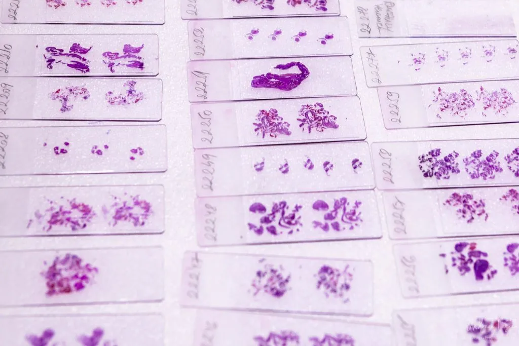 Laborator Anatomie Patologică - Clinica Medicală Amalife